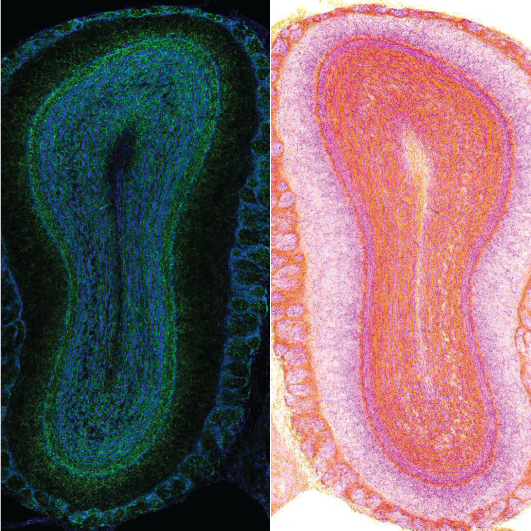 Olfactory bulb coronal sections